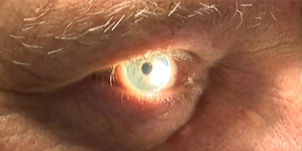 nc_tinyimplanteyepress-151025.jpg
